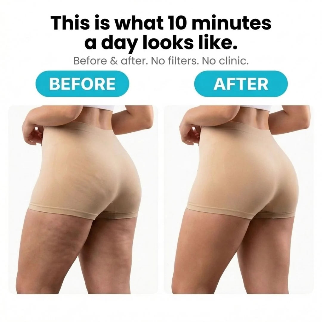 It Girl Anti-Cellulite Rotating Massager