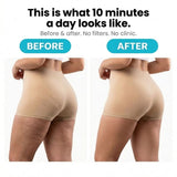 It Girl Anti-Cellulite Rotating Massager